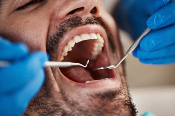 Best Emergency Denture Repair in Monon, IN