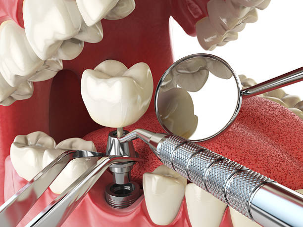 Best Emergency TMJ Treatment in Monon, IN